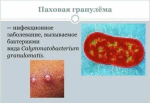 Диагностика паховой гранулемы