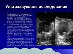 Точные методы исследования предстательной железы