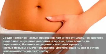 Может ли болеть правый бок внизу при цистите