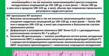 Почему перед месячными сердце сбивается с ритма Почему перед месячными сердце сбивается с ритма