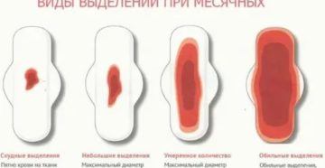 Почему не идут месячные в 14 лет а выделения есть Почему не идут месячные в 14 лет а выделения есть