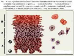 Цитология шейки матки клетки плоского эпителия промежуточного слоя