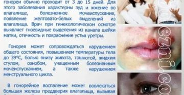 Может ли передаваться гонорея через поцелуй