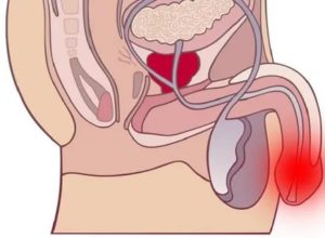 Могут при простатите быть красные губки уретры