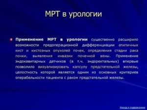 В урологии что такое мрт