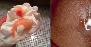 Почему вместо месячных идут прозрачные выделения Почему вместо месячных идут прозрачные выделения