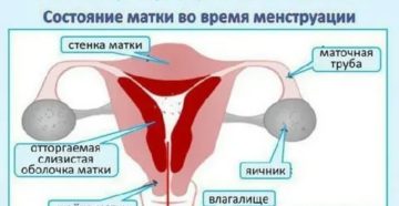 Почему вода задерживается в организме во время месячных