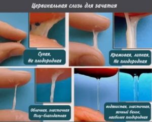 Можно ли забеременеть от смазки выделений слизи у мужчин во время месячных