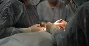 Кто делал операцию по выравниванию члена