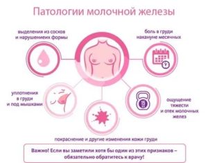Почему болят грудные железы без месячных