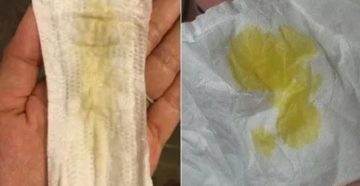 Что за выделения желто зеленого цвета после месячных Что за выделения желто зеленого цвета после месячных