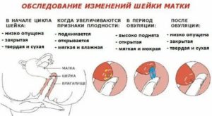 Почему матка открыта а месячных нет
