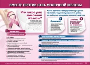 Санбюллетень что такое рак молочной железы