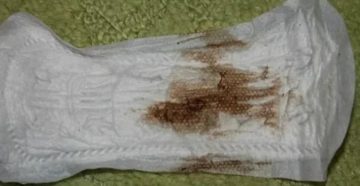 Почему после родов месячные черного цвета Почему после родов месячные черного цвета