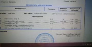 Может ли быть сифилис при отрицательном эдс