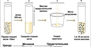 Почему после массажа простаты нельзя сдавать спермограмму в