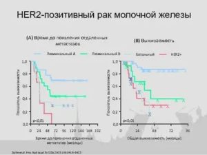 Что такое позитивный и негативный рак молочной железы