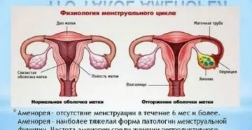 Почему нет месячных в 44 года причины Почему нет месячных в 44 года причины