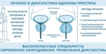 Лечение солью аденомы предстательной железы профессор окулов