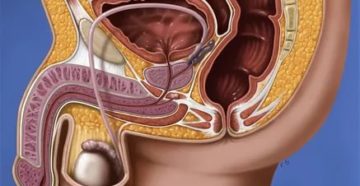 Может ли у женщины быть цистит из за простатита у мужчины
