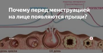 Почему появляются прыщи на лице перед и во время месячных