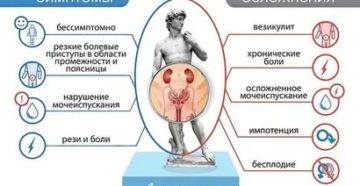 Симптомы простатита у женщин симптомы и лечение