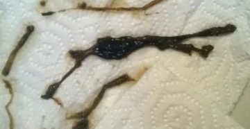 Почему во время месячных не красные а черные