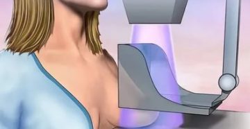 Почему нельзя делать маммографию во время месячных Почему нельзя делать маммографию во время месячных