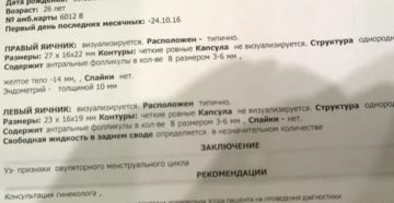 Узи матки жидкость в заднем своде что это