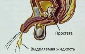 Сок предстательной железы как выглядит