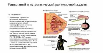 Как проявляется рецидив рака молочной железы