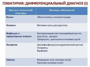 Гематурия виды причины диагностика лечение