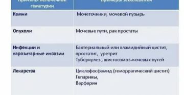 Гематурия виды причины диагностика лечение