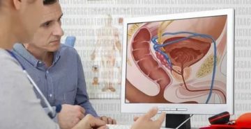Тромбоэмболия при раке предстательной железы