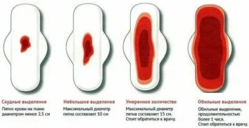 Почему выделения во время месячных могут быть скудными Почему выделения во время месячных могут быть скудными