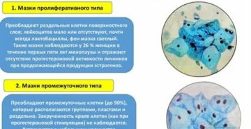 Что значит атрофический тип мазка при менопаузе Что значит атрофический тип мазка при менопаузе