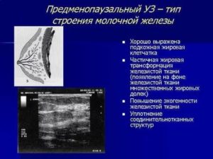 Анатомия молочной железы женщин по узи по митькову