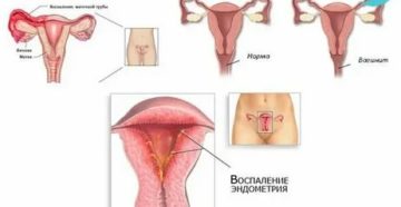 Почему иногда месячные проходят болезненно а иногда нет Почему иногда месячные проходят болезненно а иногда нет