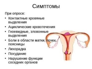 Как уменьшить выделения при раке матки