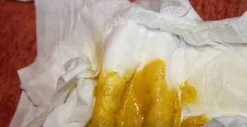 Как и чем лечить понос у 3 месячных детей