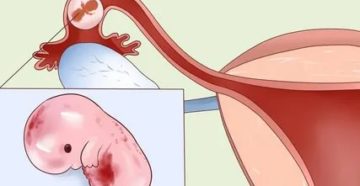 Можно ли сделать эко если нет месячных