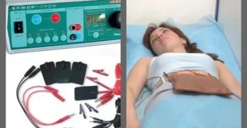 Можно ли делать физиопроцедуры увч при месячных