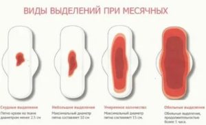Почему рано прекратились месячные