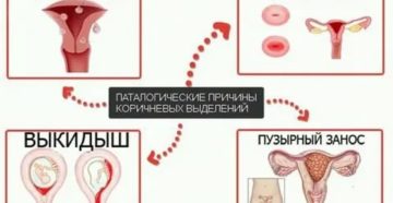 Почему после секса месячные коричневые Почему после секса месячные коричневые