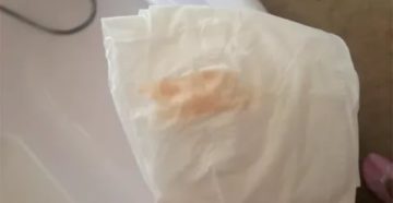 Почему нет месячных а идут выделения кремового цвета