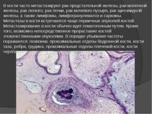 Рак предстательной железы метастазы в щитовидную железу