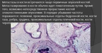 Рак предстательной железы метастазы в щитовидную железу