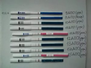 Может ли тянуть низ живота после имплантации