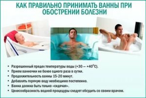 При простатите можно ли принимать горячие ванны при