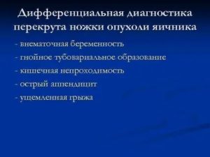 Дифференциальная диагностика перекрута ножки опухоли яичника